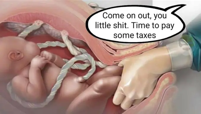 taxes